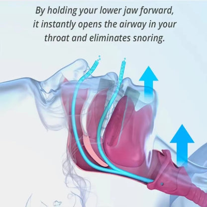 Transparent Silicone Tongue Case Anti-snoring Device