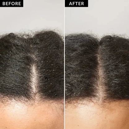 Dermo Cleanse Scalp Comb